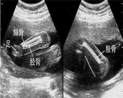 安徽排名前五的三代试管婴儿医院有哪些？附详细信息！