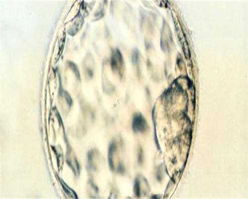 杭州试管怀孕微信交流群、试管交流微信群