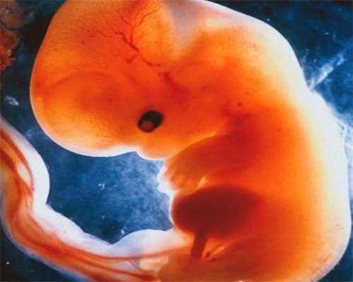 代孕供卵试管：输卵管粘连怎么能治好