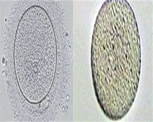 试管代生官网：盆腔炎患者试管婴儿成功概率，盆腔炎做试管婴儿成功率高吗？