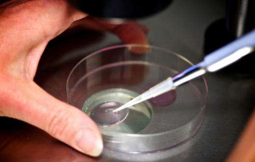 助孕单身女性：十公分子宫肌瘤切除记（15）-腹腔镜手术第一天