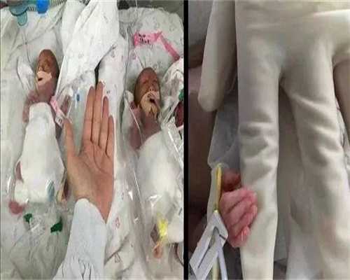 胚胎移植后侧身睡觉的影响？侧身睡觉会宫外孕吗？