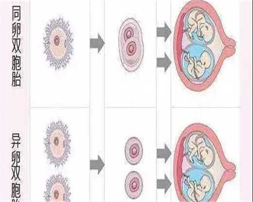 助孕网成功率：月经二十多天未干净的原因是什么？