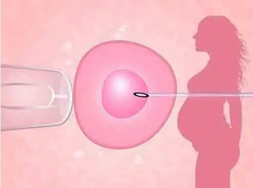盘点合肥第三代试管婴儿的成功率和费用